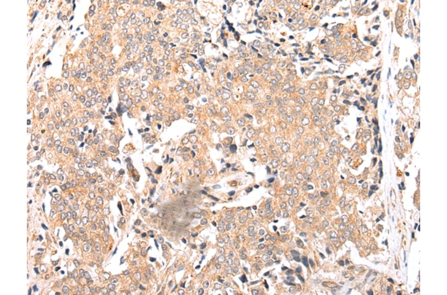 Immunohistochemistry - FPR1 Antibody from Signalway Antibody (43271) - Antibodies.com