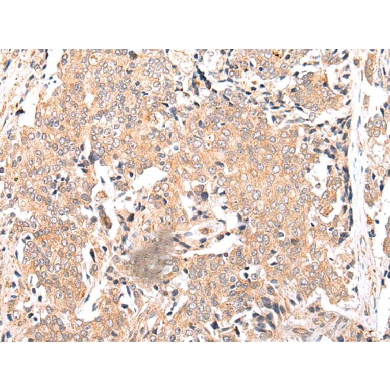 Immunohistochemistry - FPR1 Antibody from Signalway Antibody (43271) - Antibodies.com