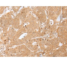 Immunohistochemistry - PEG3 Antibody from Signalway Antibody (43302) - Antibodies.com