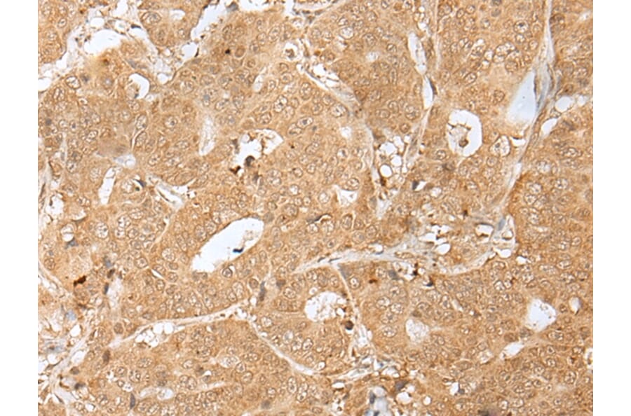 Immunohistochemistry - PEG3 Antibody from Signalway Antibody (43302) - Antibodies.com