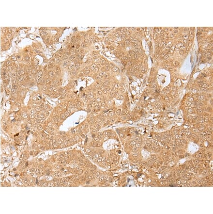 Immunohistochemistry - PEG3 Antibody from Signalway Antibody (43302) - Antibodies.com