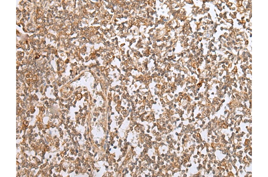 Immunohistochemistry - PEG3 Antibody from Signalway Antibody (43302) - Antibodies.com