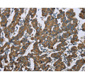 Immunohistochemistry - KRT5 Antibody from Signalway Antibody (43316) - Antibodies.com