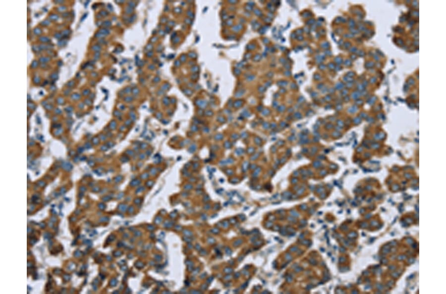 Immunohistochemistry - KRT5 Antibody from Signalway Antibody (43316) - Antibodies.com