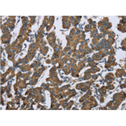 Immunohistochemistry - KRT5 Antibody from Signalway Antibody (43316) - Antibodies.com