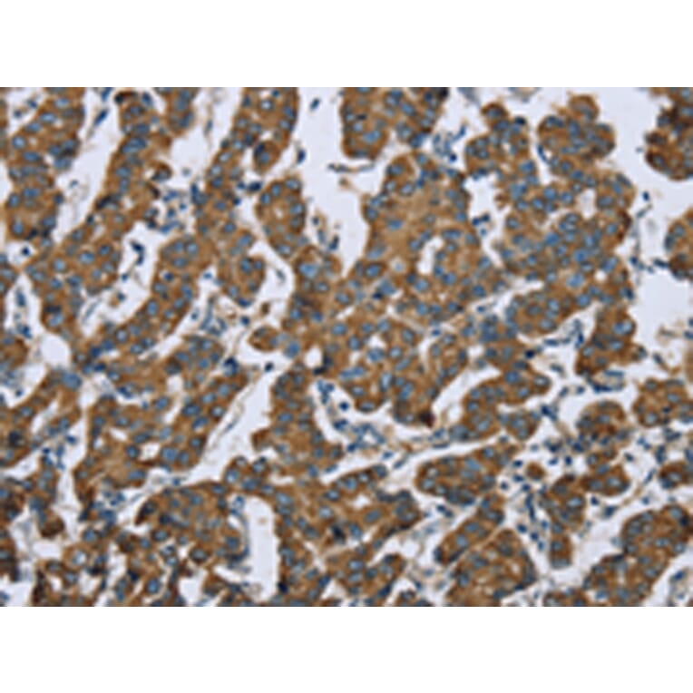 Immunohistochemistry - KRT5 Antibody from Signalway Antibody (43316) - Antibodies.com