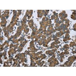 Immunohistochemistry - KRT5 Antibody from Signalway Antibody (43316) - Antibodies.com