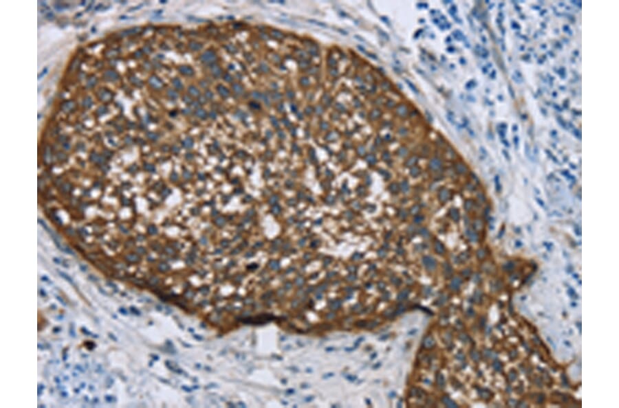 Immunohistochemistry - KRT5 Antibody from Signalway Antibody (43316) - Antibodies.com