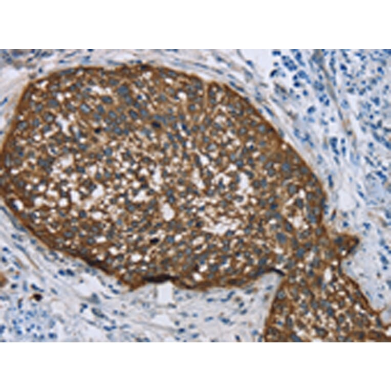 Immunohistochemistry - KRT5 Antibody from Signalway Antibody (43316) - Antibodies.com