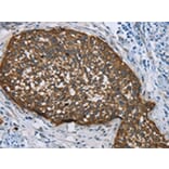 Immunohistochemistry - KRT5 Antibody from Signalway Antibody (43316) - Antibodies.com