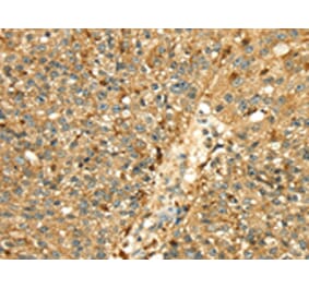 Immunohistochemistry - CTSH Antibody from Signalway Antibody (43317) - Antibodies.com