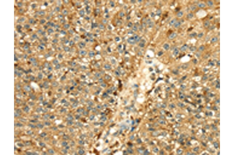 Immunohistochemistry - CTSH Antibody from Signalway Antibody (43317) - Antibodies.com
