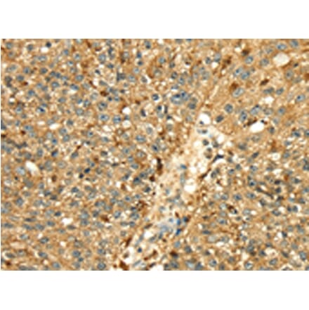 Immunohistochemistry - CTSH Antibody from Signalway Antibody (43317) - Antibodies.com