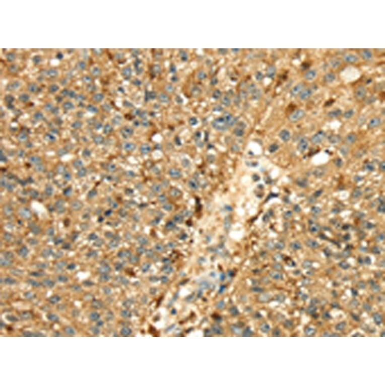 Immunohistochemistry - CTSH Antibody from Signalway Antibody (43317) - Antibodies.com