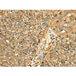 Immunohistochemistry - CTSH Antibody from Signalway Antibody (43317) - Antibodies.com