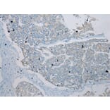 Immunohistochemistry - TLK2 Antibody from Signalway Antibody (43337) - Antibodies.com