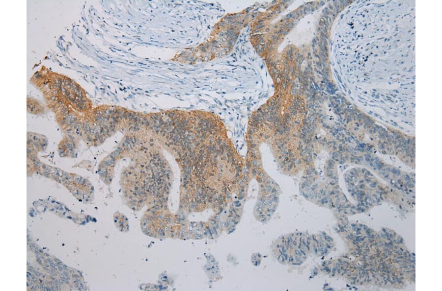 Immunohistochemistry - TLK2 Antibody from Signalway Antibody (43337) - Antibodies.com