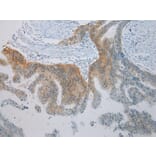 Immunohistochemistry - TLK2 Antibody from Signalway Antibody (43337) - Antibodies.com