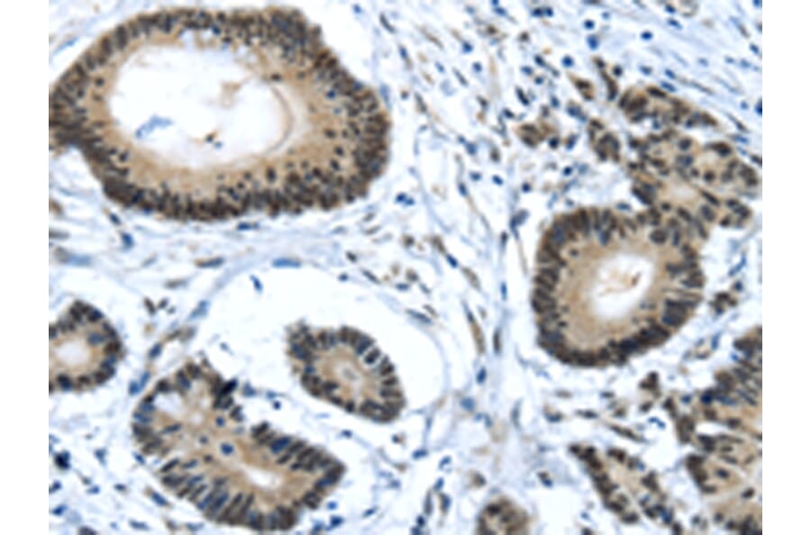 Immunohistochemistry - MED4 Antibody from Signalway Antibody (43340) - Antibodies.com