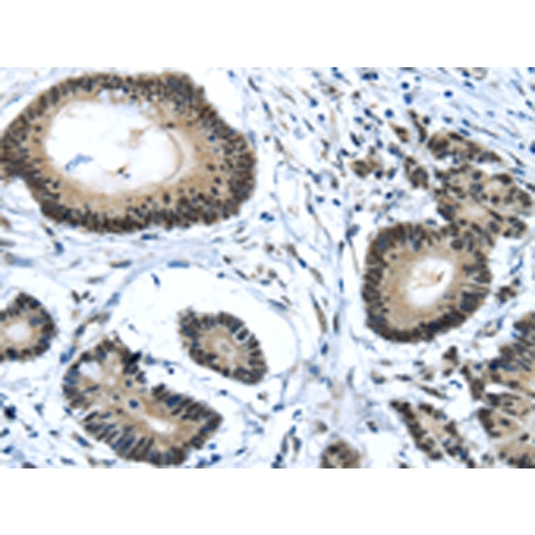 Immunohistochemistry - MED4 Antibody from Signalway Antibody (43340) - Antibodies.com