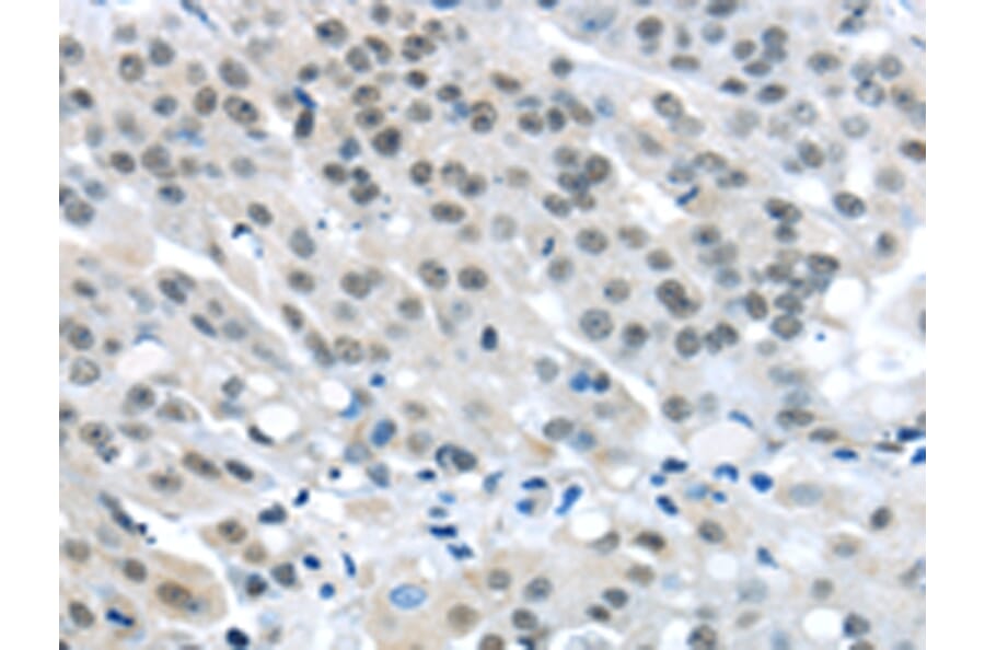 Immunohistochemistry - MED4 Antibody from Signalway Antibody (43340) - Antibodies.com