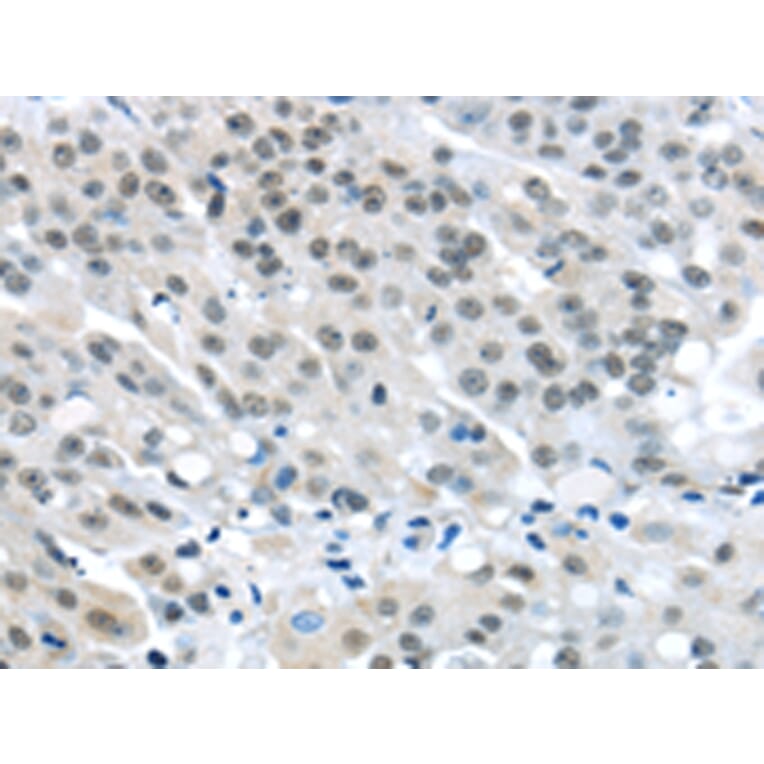 Immunohistochemistry - MED4 Antibody from Signalway Antibody (43340) - Antibodies.com