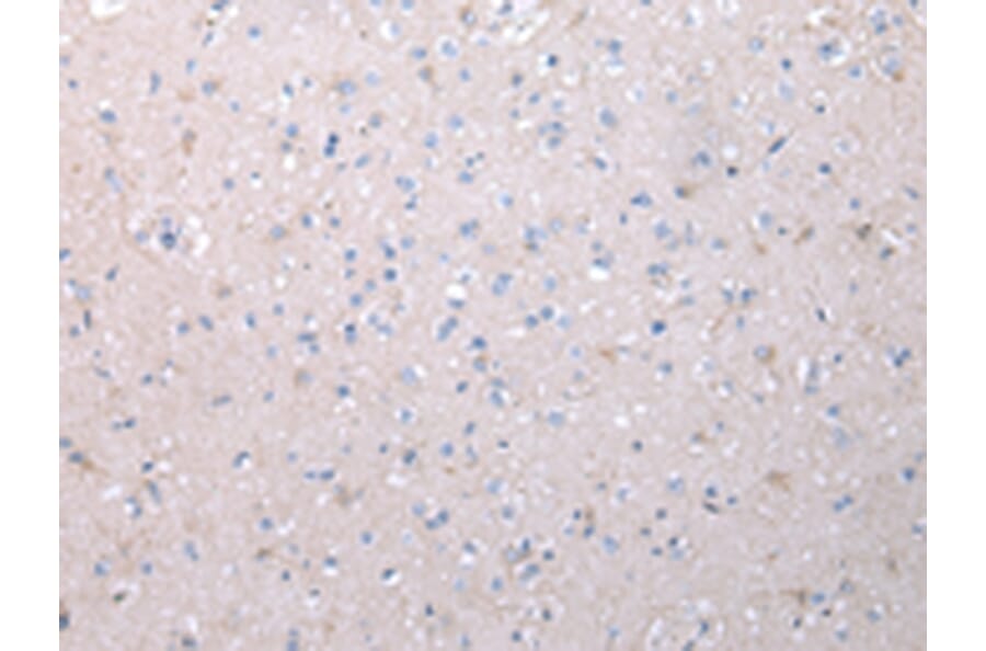 Immunohistochemistry - VCAN Antibody from Signalway Antibody (43346) - Antibodies.com
