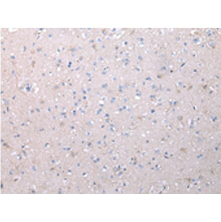 Immunohistochemistry - VCAN Antibody from Signalway Antibody (43346) - Antibodies.com