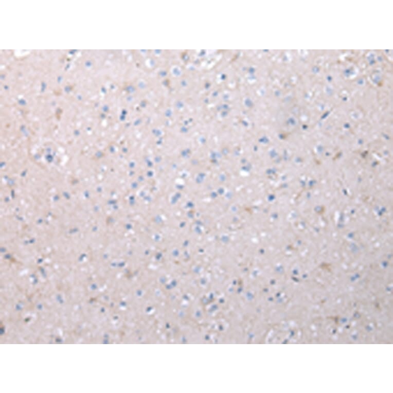 Immunohistochemistry - VCAN Antibody from Signalway Antibody (43346) - Antibodies.com