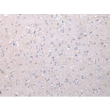 Immunohistochemistry - VCAN Antibody from Signalway Antibody (43346) - Antibodies.com