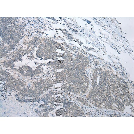 Immunohistochemistry - BBS9 Antibody from Signalway Antibody (43360) - Antibodies.com