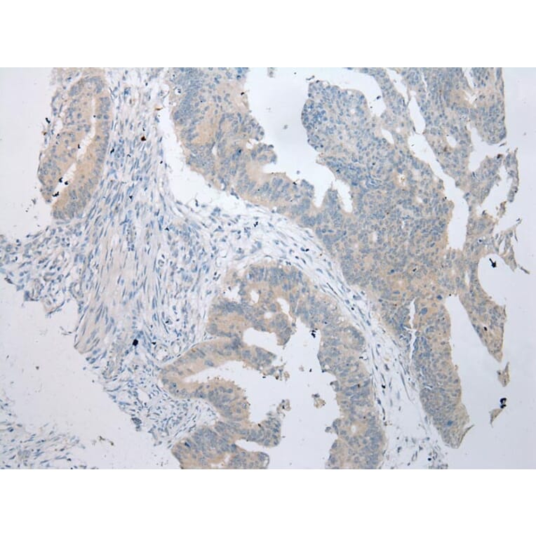 Immunohistochemistry - BBS9 Antibody from Signalway Antibody (43360) - Antibodies.com