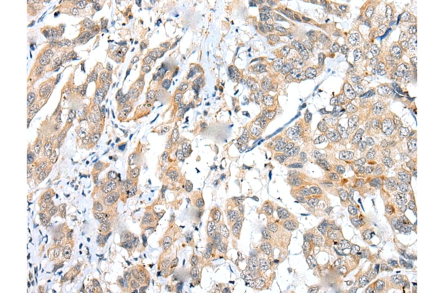 Immunohistochemistry - FUOM Antibody from Signalway Antibody (43370) - Antibodies.com