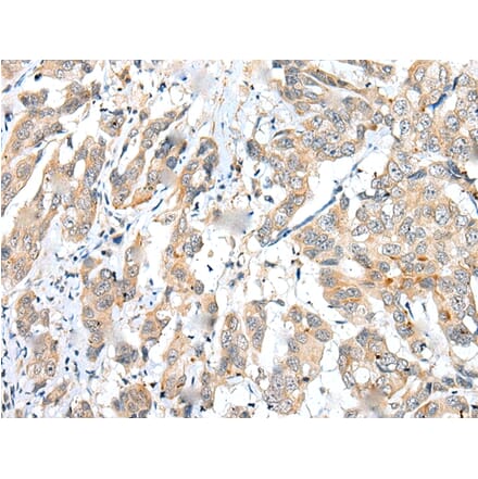 Immunohistochemistry - FUOM Antibody from Signalway Antibody (43370) - Antibodies.com