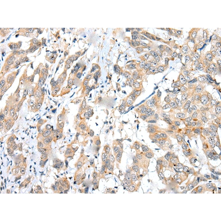 Immunohistochemistry - FUOM Antibody from Signalway Antibody (43370) - Antibodies.com