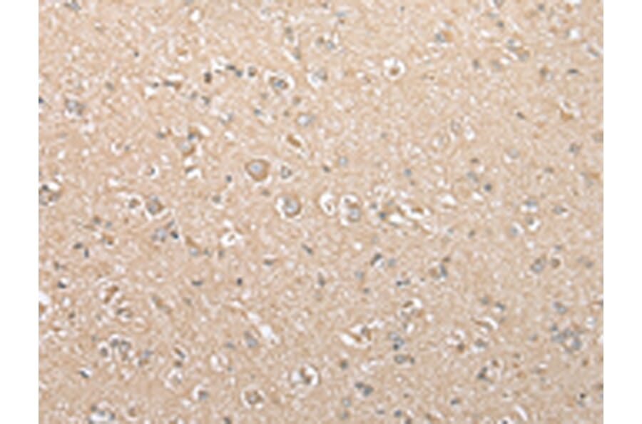 Immunohistochemistry - USE1 Antibody from Signalway Antibody (43379) - Antibodies.com