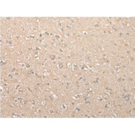 Immunohistochemistry - USE1 Antibody from Signalway Antibody (43379) - Antibodies.com