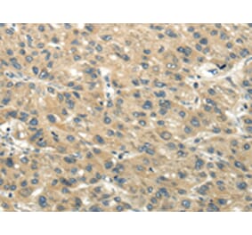 Immunohistochemistry - CHGB Antibody from Signalway Antibody (43395) - Antibodies.com