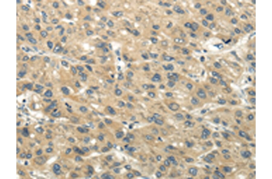 Immunohistochemistry - CHGB Antibody from Signalway Antibody (43395) - Antibodies.com