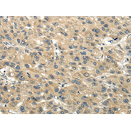 Immunohistochemistry - CHGB Antibody from Signalway Antibody (43395) - Antibodies.com