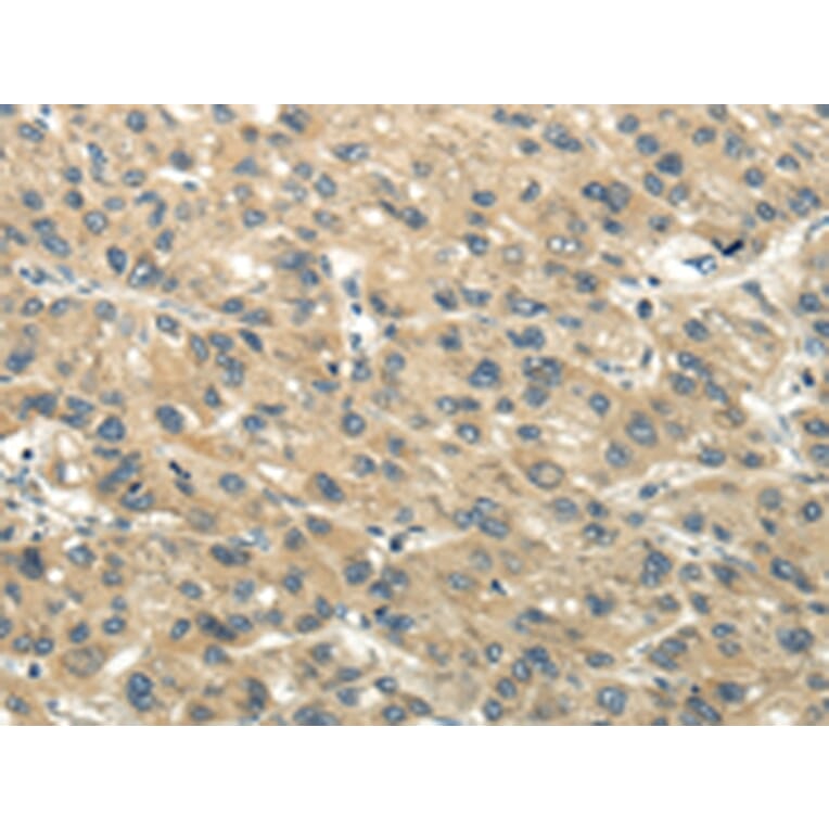 Immunohistochemistry - CHGB Antibody from Signalway Antibody (43395) - Antibodies.com