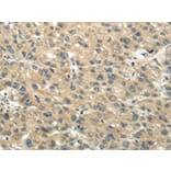 Immunohistochemistry - CHGB Antibody from Signalway Antibody (43395) - Antibodies.com