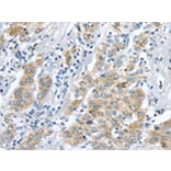 Immunohistochemistry - LRP6 Antibody from Signalway Antibody (43398) - Antibodies.com