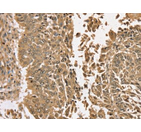 Immunohistochemistry - TGM6 Antibody from Signalway Antibody (43425) - Antibodies.com