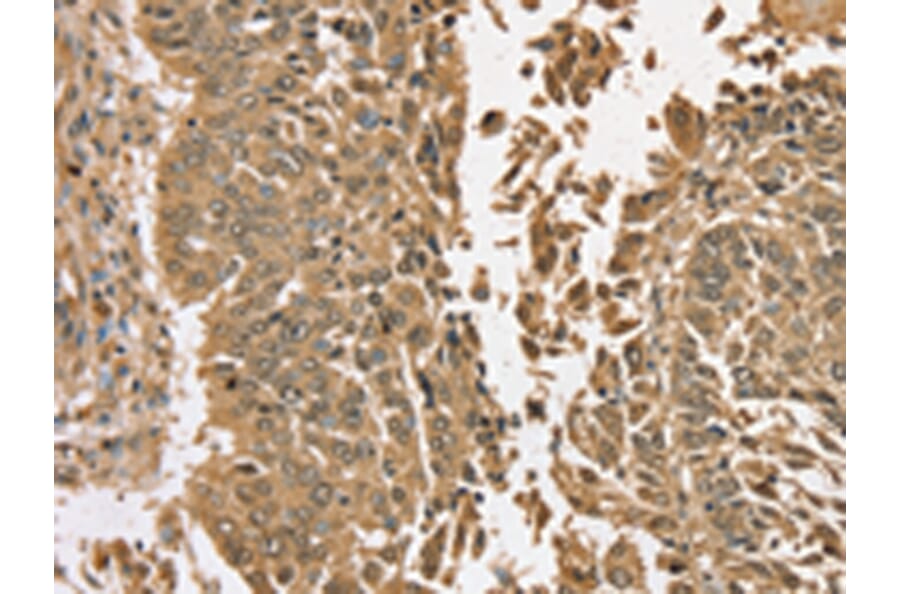Immunohistochemistry - TGM6 Antibody from Signalway Antibody (43425) - Antibodies.com