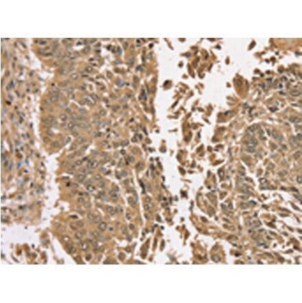 Immunohistochemistry - TGM6 Antibody from Signalway Antibody (43425) - Antibodies.com