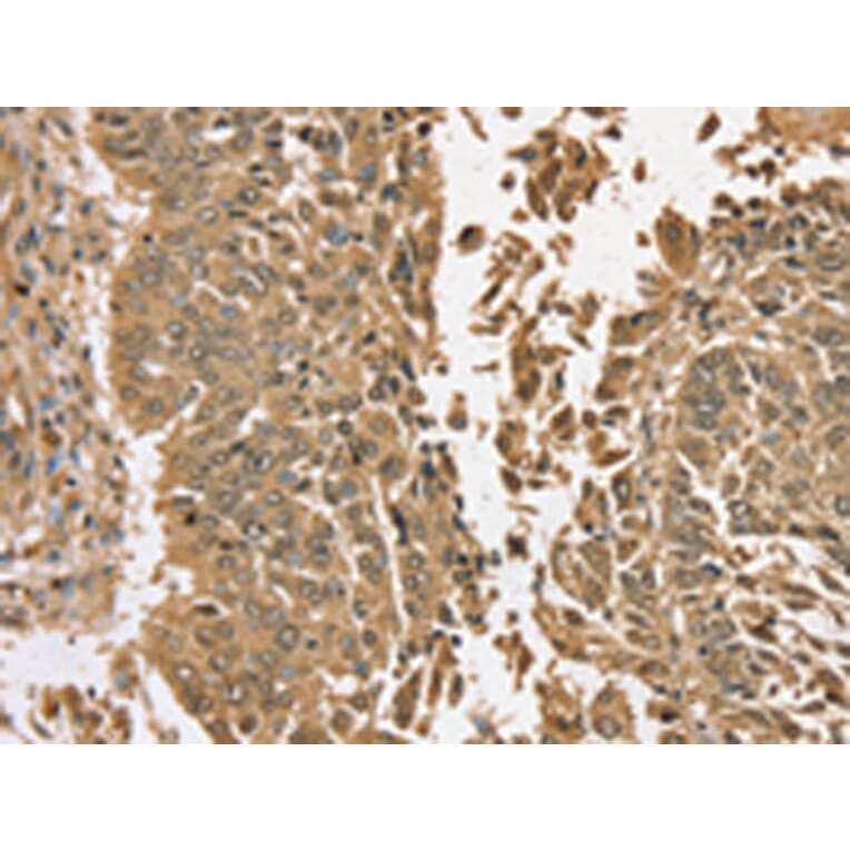 Immunohistochemistry - TGM6 Antibody from Signalway Antibody (43425) - Antibodies.com
