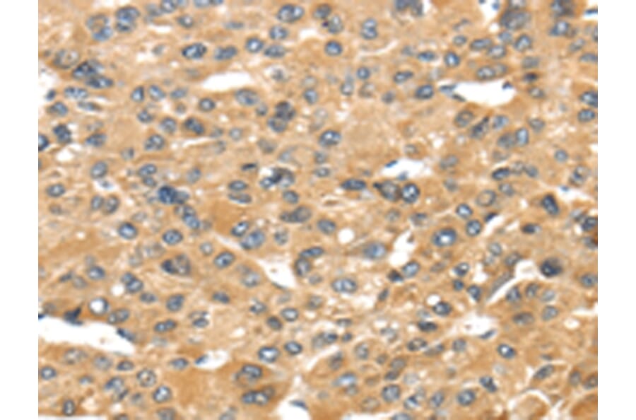 Immunohistochemistry - UCP1 Antibody from Signalway Antibody (43429) - Antibodies.com