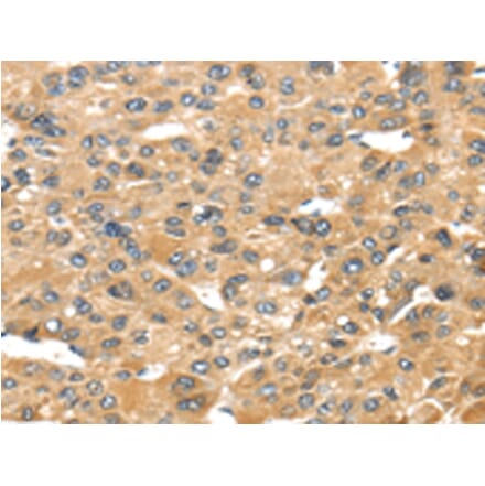 Immunohistochemistry - UCP1 Antibody from Signalway Antibody (43429) - Antibodies.com