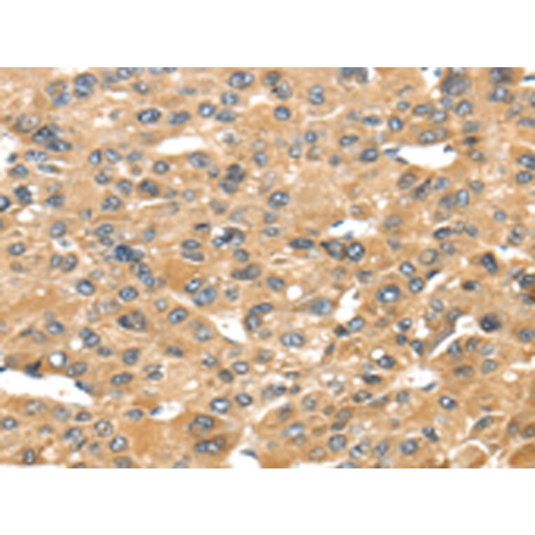 Immunohistochemistry - UCP1 Antibody from Signalway Antibody (43429) - Antibodies.com